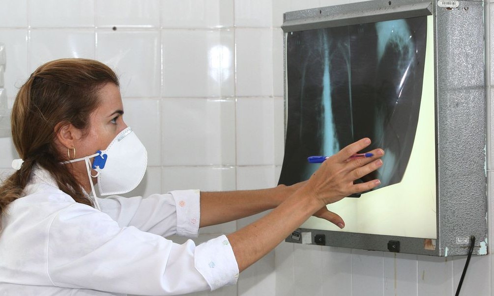 Fiocruz vai testar eficácia da vacina contra tuberculose para covid-19