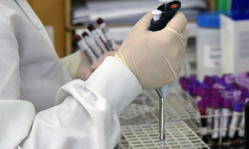 Hospital das Clínicas de SP descarta reinfecção de Covid-19 em 22 pacientes