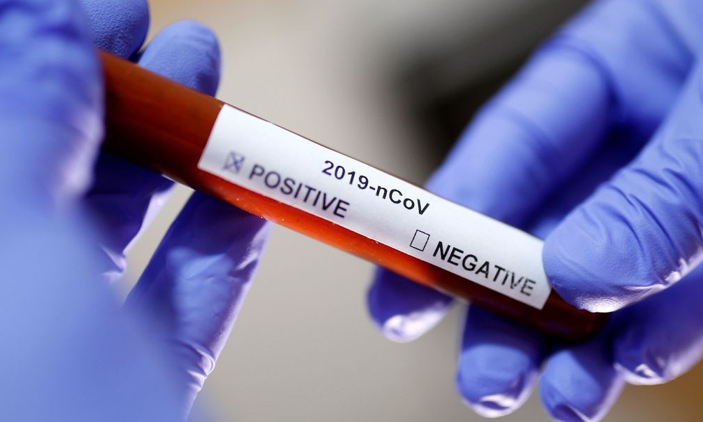 90% dos pacientes relatam sintomas até três meses depois da infecção