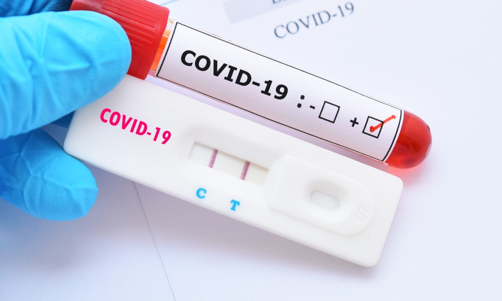 Covid-19: testes podem estar dando positivo com vírus ‘morto’, diz cientista