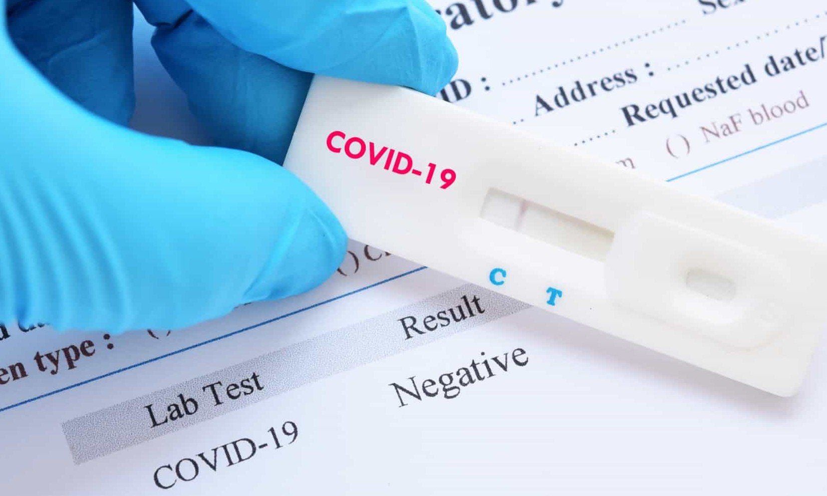 Covid-19: Ministério da Saúde tem 9,5 milhões de testes estocados