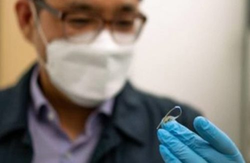 Implante que controla apetite pode ser substituto da cirurgia bariátrica - Jornal da Franca