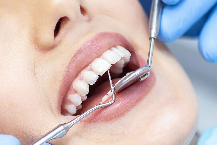 Descuido na higiene bucal pode ocasionar consequências sérias não só para os dentes