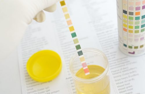 Exame de urina pode detectar câncer de próstata com quase 100% de precisão - Jornal da Franca