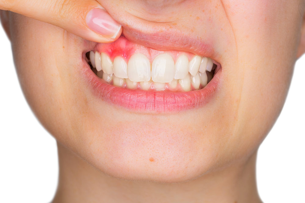 Saúde bucal influencia diretamente em todo o organismo