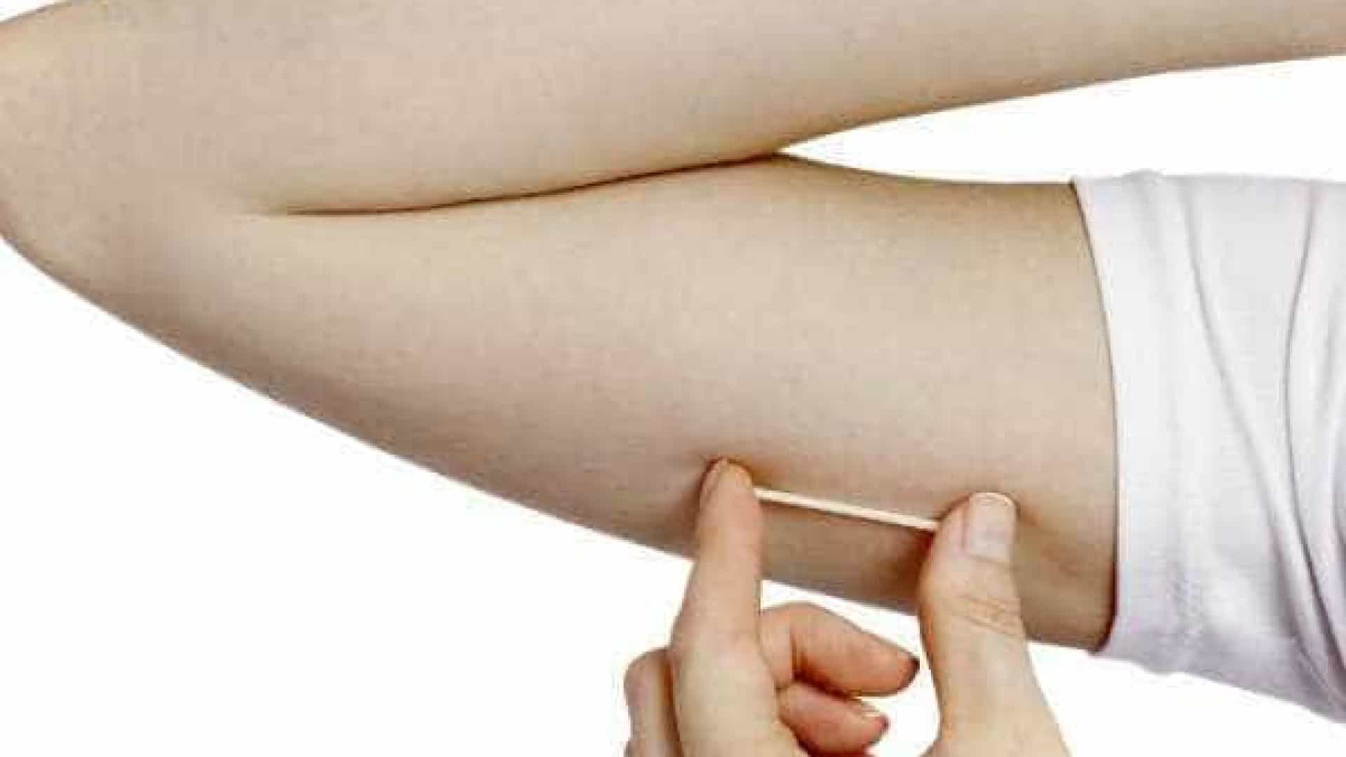 Implante contraceptivo e chip hormonal: conheça e entenda as diferenças