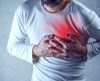Covid-19: pacientes têm 4 vezes mais chances de sofrer parada cardíaca fatal - Jornal da Franca