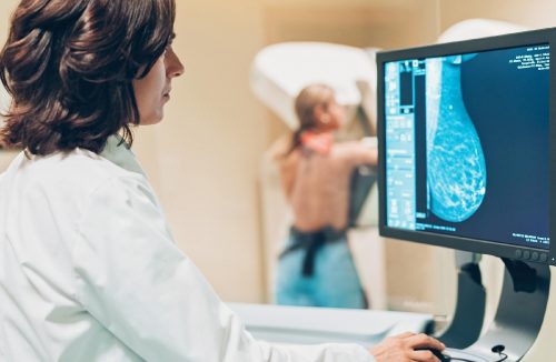 Secretaria de Saúde de Franca realiza Sábado da Mulher com mamografia e papanicolau - Jornal da Franca