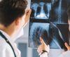 Mutirão de consultas de ortopedia será realizado em Franca nesta quarta-feira, 21 - Jornal da Franca