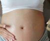 Dermatologista diz que óleo NÃO previne estrias na gravidez. Veja o que funciona! - Jornal da Franca
