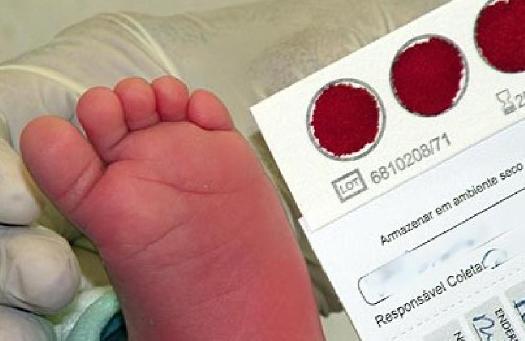 Teste do pezinho no SUS será ampliado para detectar mais doenças – veja como será