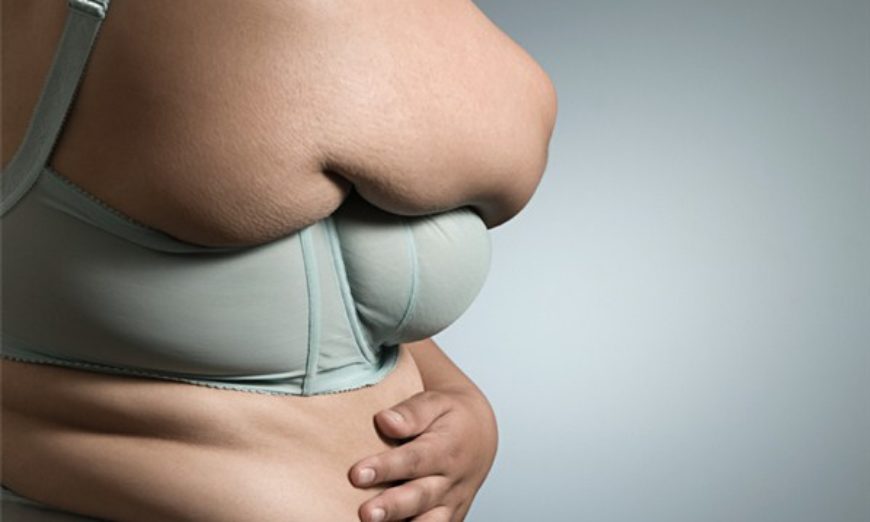 Obesidade é fator de risco para câncer de mama e pode diminuir chances de cura