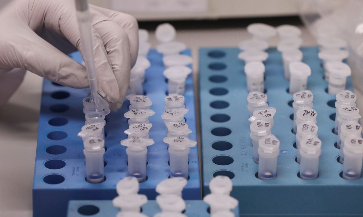 Teste para detecção de covid-19, por R$ 30,00, é criado por universidade brasileira