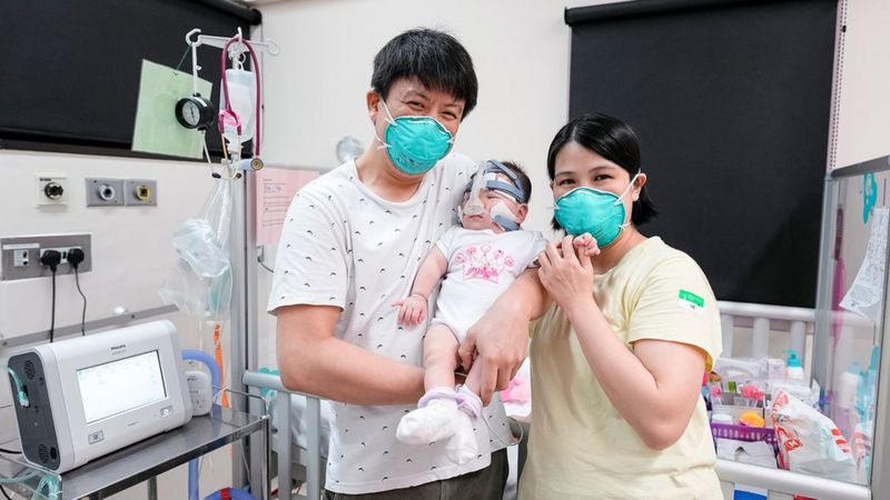 Menor bebê prematuro do mundo, nascida com peso de uma maçã, tem alta após 13 meses
