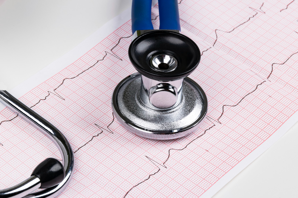Hapvida integra sistemas e disponibiliza laudos de eletrocardiograma em 15 minutos