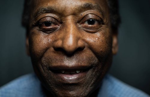 Aos 80 anos, Pelé segue em tratamento e se recupera de forma “muito satisfatória” - Jornal da Franca