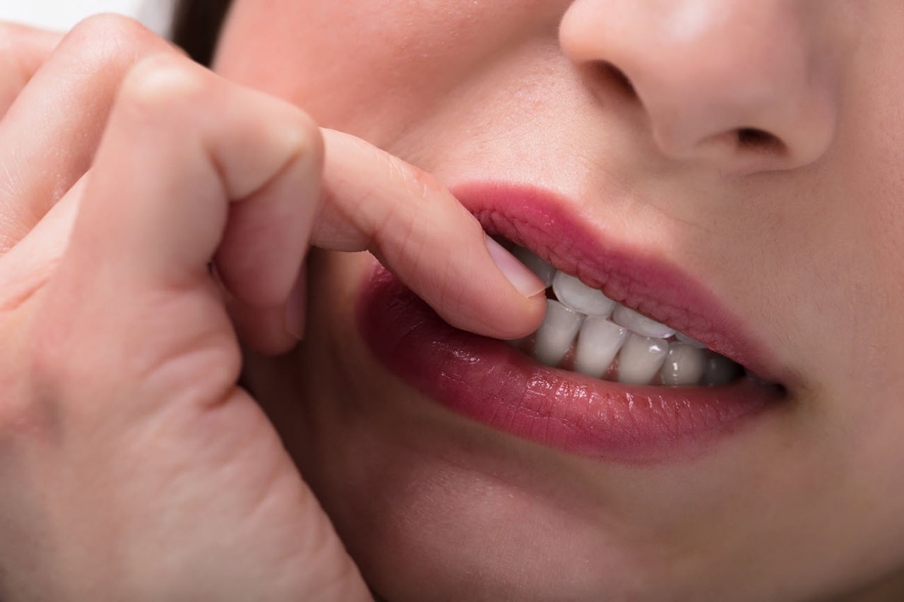 Um hábito nada saudável: roer as unhas é abrir o corpo para doenças diversas