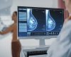 Médicos reforçam importância de fazer mamografia após os 40 anos de idade - Jornal da Franca