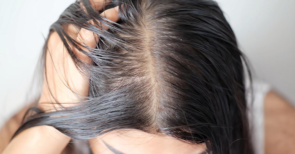 Cinco dicas infalíveis para disfarçar o cabelo oleoso