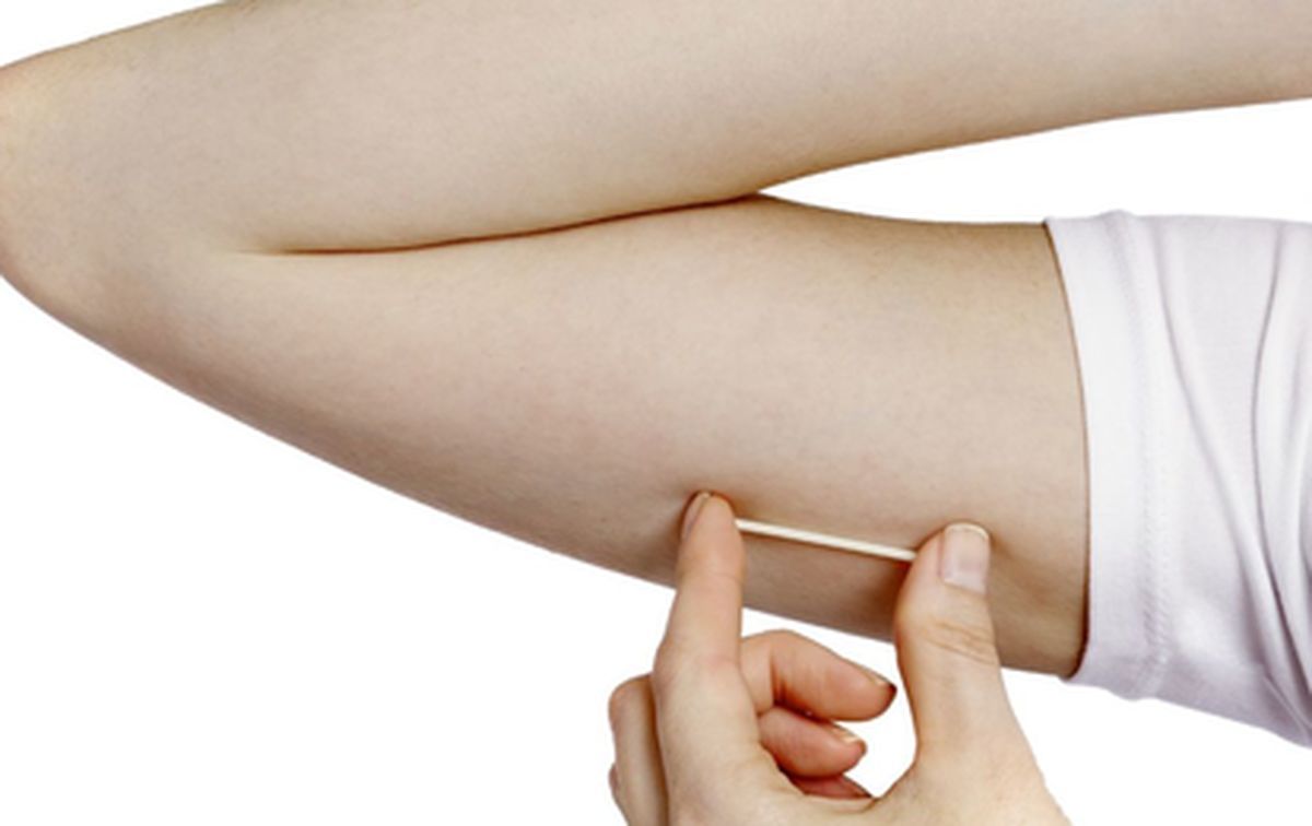 Com recursos da deputada Graciela, Franca busca mulheres para implante contraceptivo