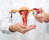 Endometriose: veja alimentos que ajudam a reduzir os sintomas - Jornal da Franca