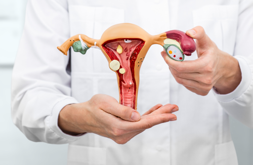 Endometriose: veja alimentos que ajudam a reduzir os sintomas - Jornal da Franca