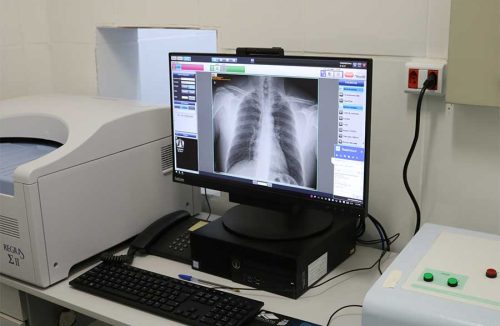Raio X digital reduz exposição à radiação e tempo de espera do paciente em hospital - Jornal da Franca