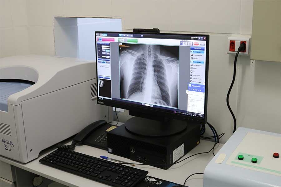 Raio X digital reduz exposição à radiação e tempo de espera do paciente em hospital