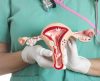 Prevenção: Câncer de ovário mata 7 em cada 10 mulheres no Brasil, segundo Inca - Jornal da Franca