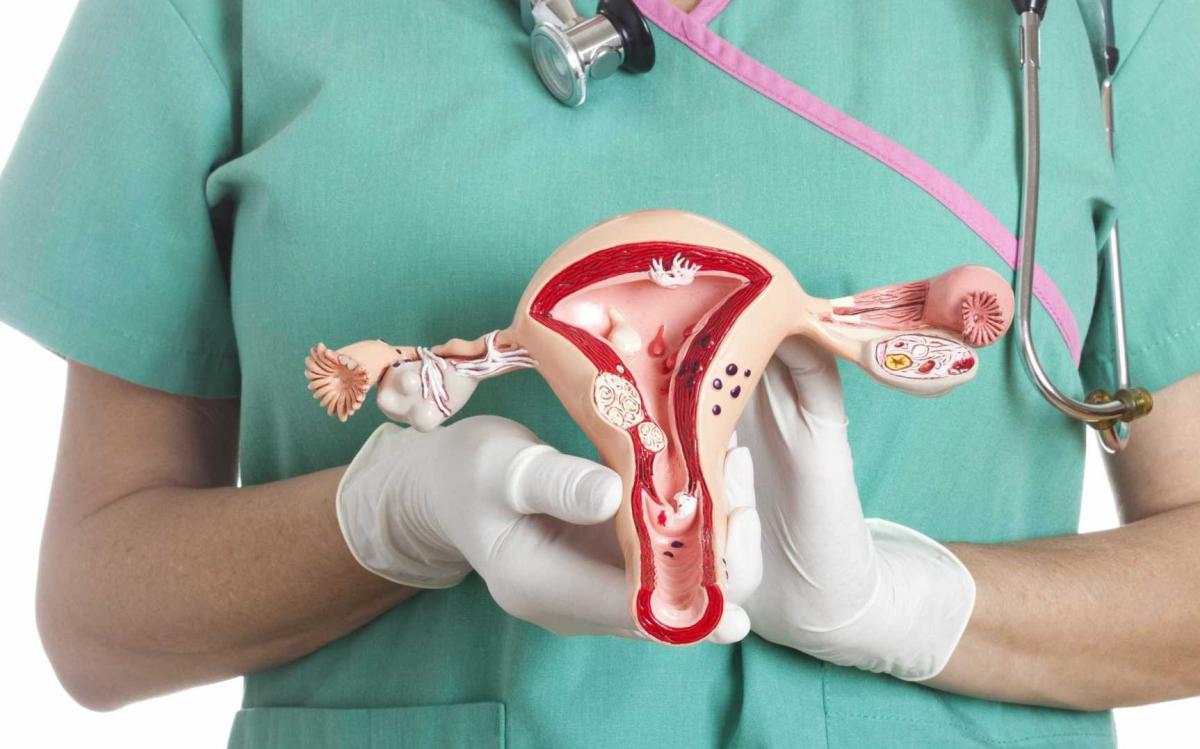 Prevenção: Câncer de ovário mata 7 em cada 10 mulheres no Brasil, segundo Inca