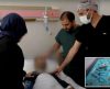 Médicos retiram 233 objetos do estômago de paciente: baterias, moedas, parafusos… - Jornal da Franca