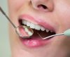 Hapvida Interodonto ultrapassa 7 milhões de beneficiários, no mês dos dentistas - Jornal da Franca