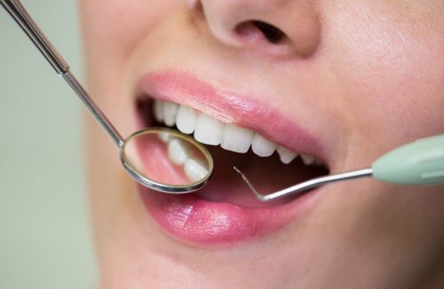 Hapvida Interodonto ultrapassa 7 milhões de beneficiários, no mês dos dentistas - Jornal da Franca