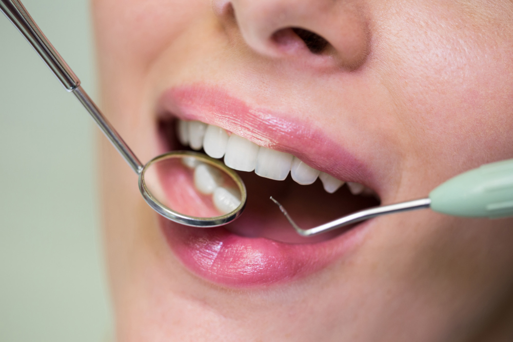 Hapvida Interodonto ultrapassa 7 milhões de beneficiários, no mês dos dentistas