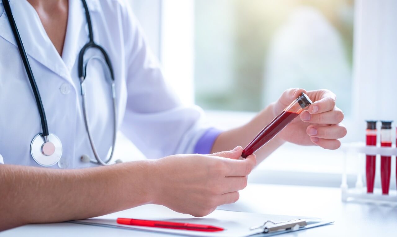 AVC precoce pode ser mais comum em certos tipos sanguíneos – será que é o seu?