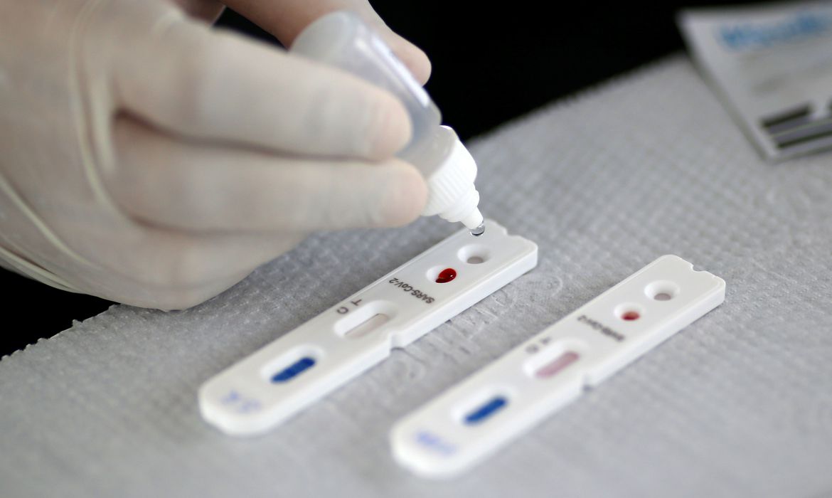 Casos de Covid-19 aumentam 240% em duas semanas, e Fiocruz alerta para alta em SP