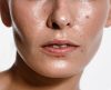 A pele oleosa te causa desconforto? Aprenda como diminuir essa sensação - Jornal da Franca