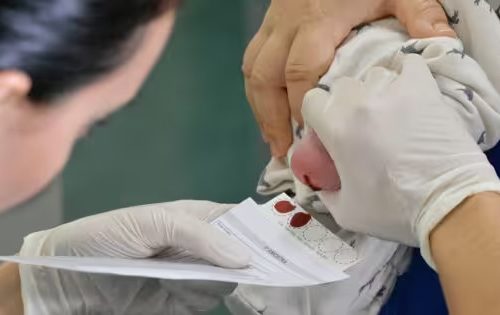 Médico brasileiro cria novo teste do pezinho que identifica mais de 50 doenças - Jornal da Franca