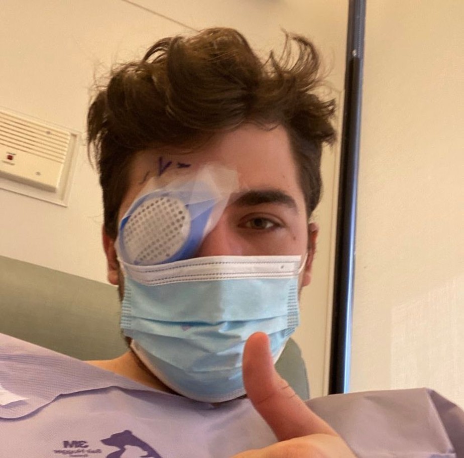 Homem fica cego de um olho depois de dormir com lentes de contato; entenda os riscos