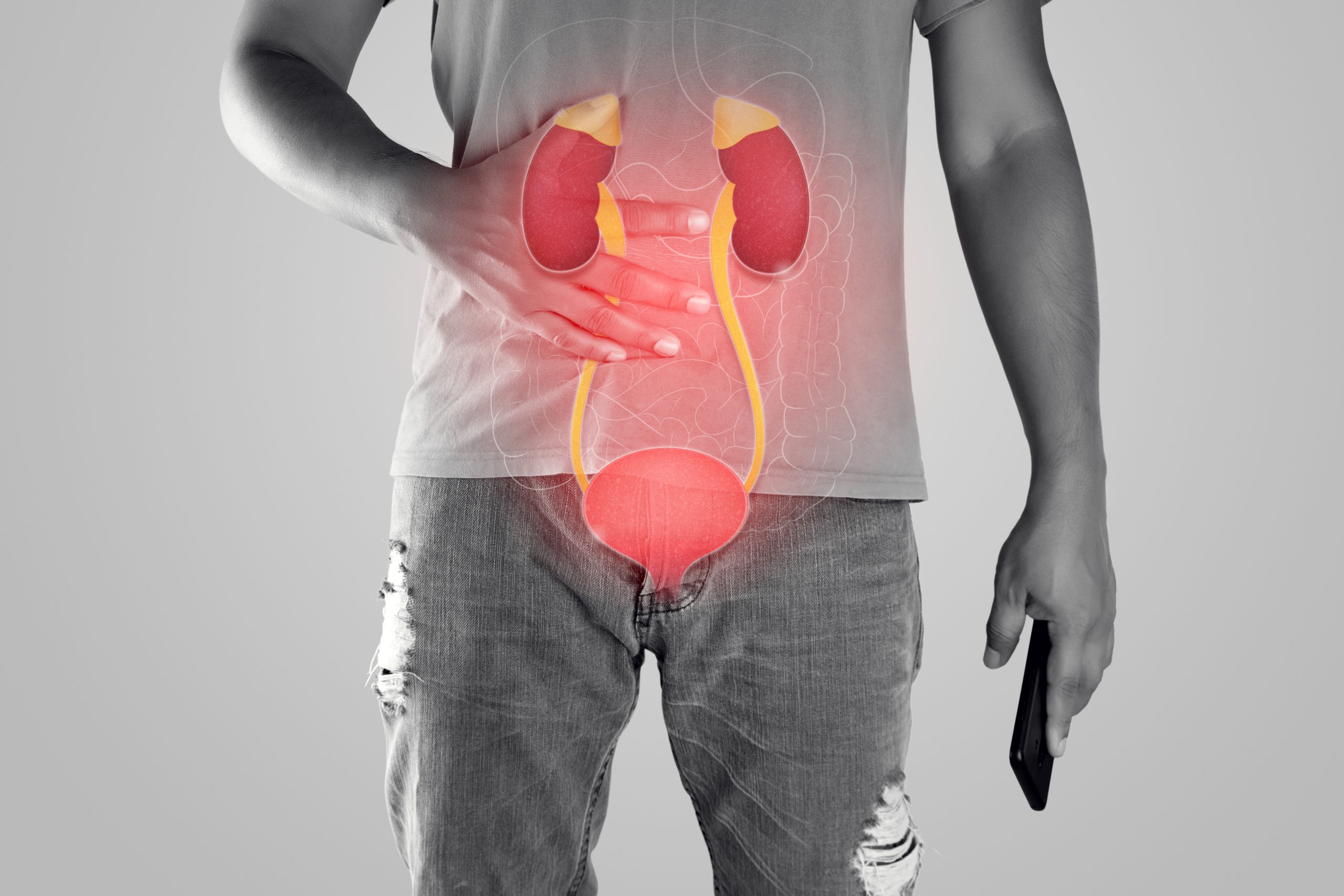 Pedras nos rins ou infecção urinária? Veja 7 sinais que ajudam a distinguir