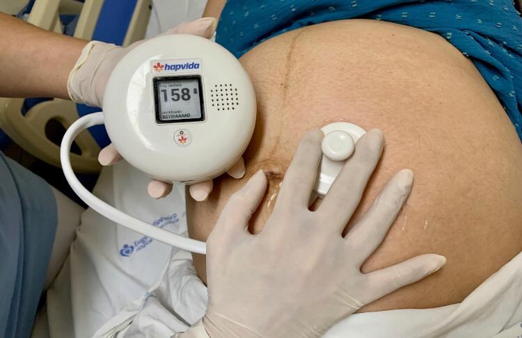 Hapvida e Senai Ceará lançam detector de frequência cardíaca fetal com IA