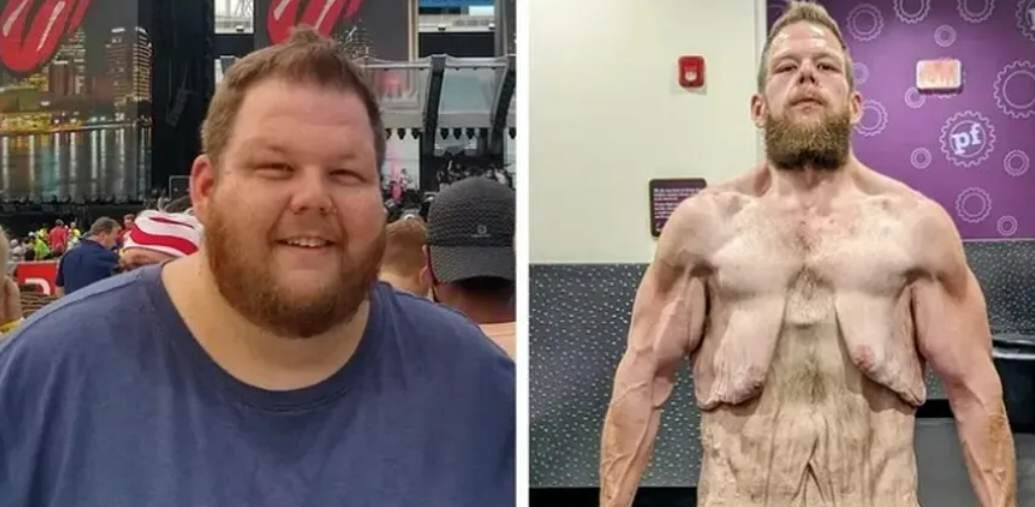 Isso é que é determinação: homem consegue eliminar mais de 160 quilos sem remédios