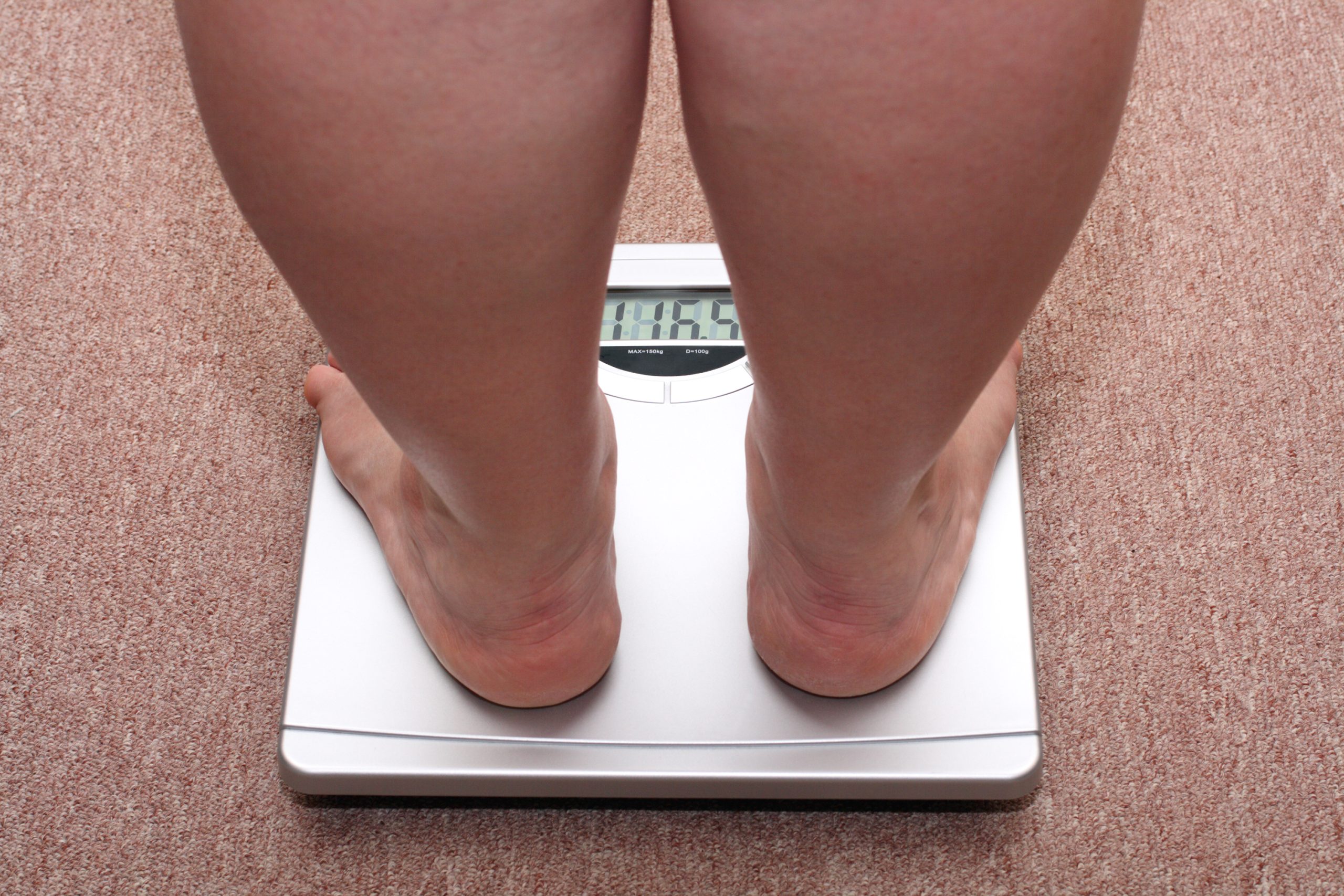 Lipedema ou obesidade? Especialista aponta diferenças entre os quadros