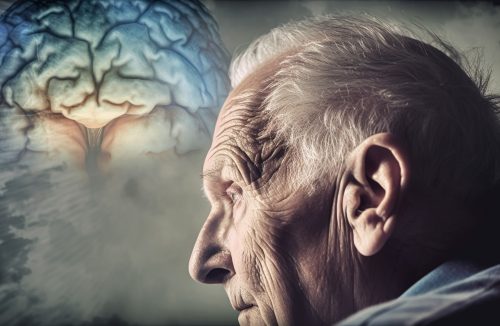 Alzheimer: estudo mostra o que pode causar a morte de neurônios - Jornal da Franca