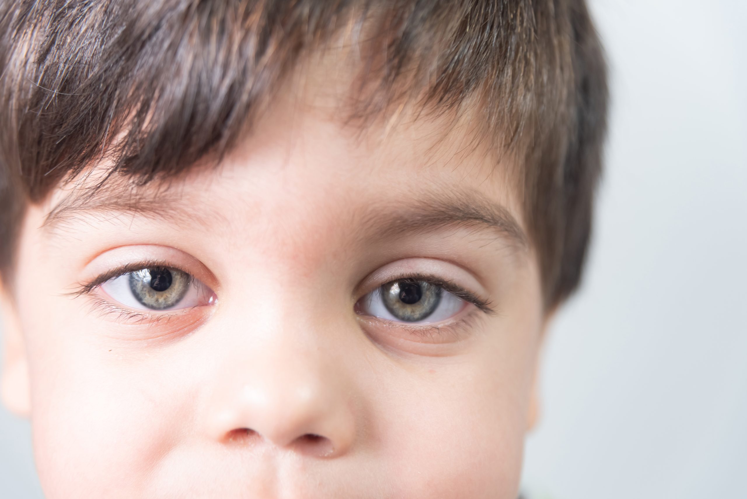 Autismo: inteligência artificial diagnostica condição com 100% de precisão