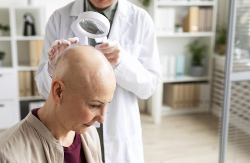 Câncer de pele: couro cabeludo pode ser afetado por tumor; veja quais cuidados tomar - Jornal da Franca