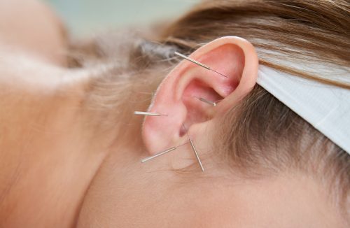 Estudo confirma benefício da acupuntura auricular no tratamento da depressão - Jornal da Franca