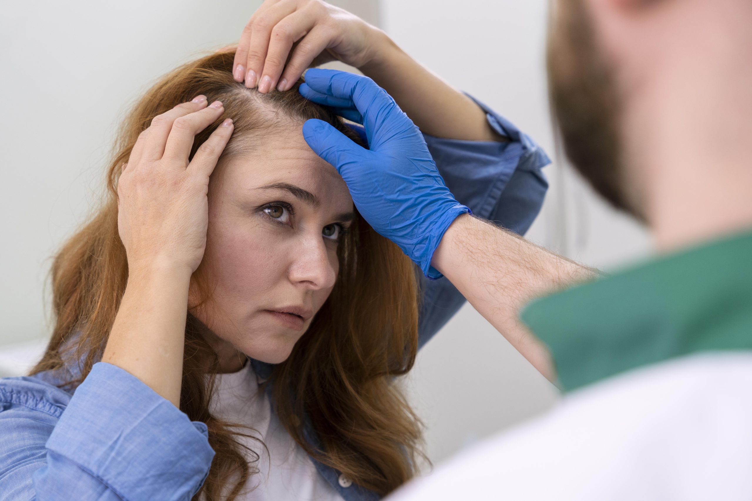 Transplante capilar feminino: saiba quando é indicado e como é feito o procedimento