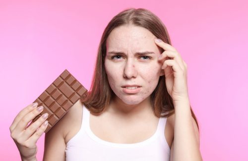 Chocolate causa acne? Saiba a verdade por trás dessa dúvida! - Jornal da Franca