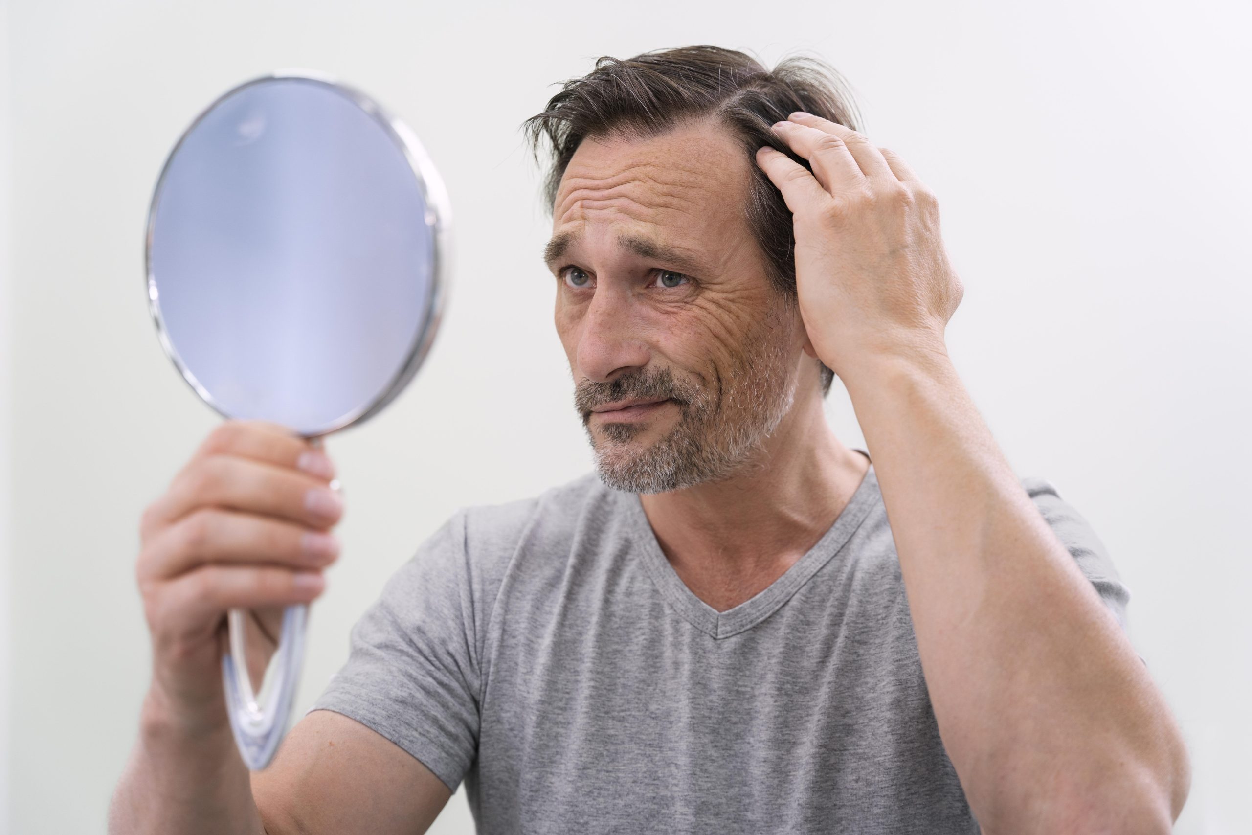 Dengue pode causar queda de cabelo? Especialistas explicam